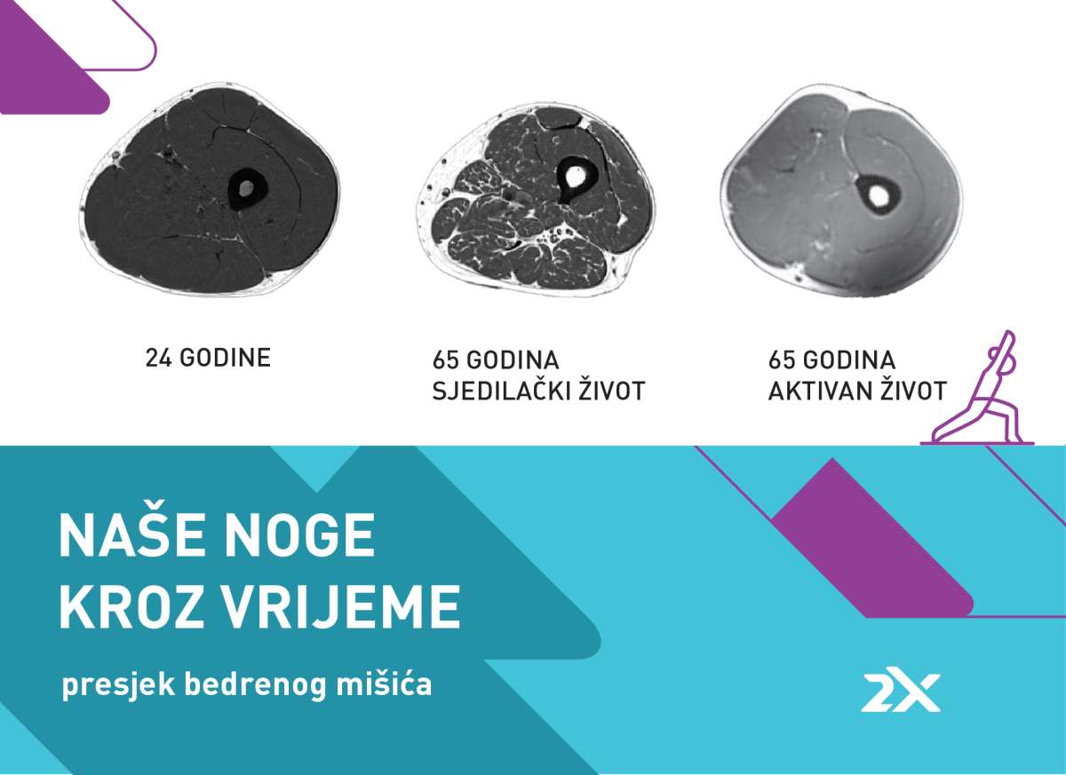 Mit o čarobnih 10.000 koraka i nevidljivi ubojica mladosti